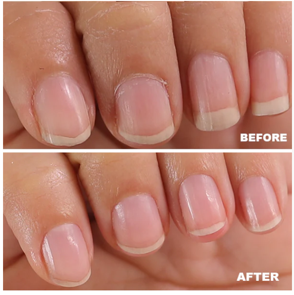 All in One Manicure Set